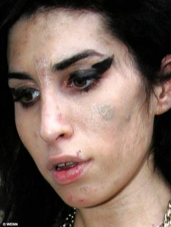 Faţa lui Amy Winehouse se descompune