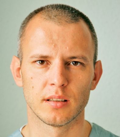 DOCTOR EVZ: Ridurile pot fi corectate cu grăsime proprie