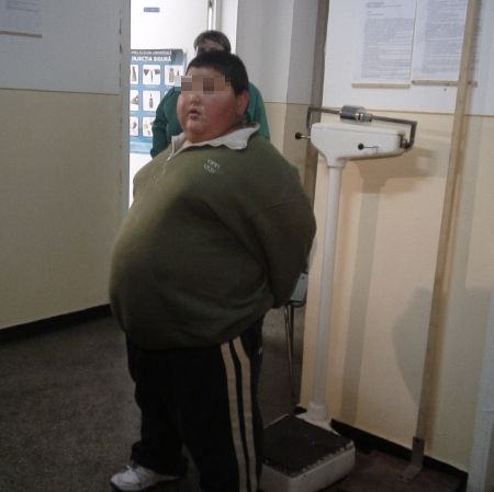 Copilul de 100 de kilograme, pus la slăbit