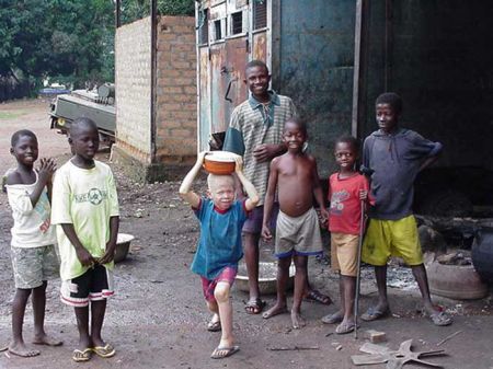 Albinoşii, ucişi în masă în Tanzania