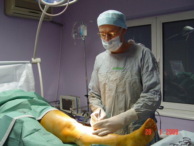 operaiuni minim invazive în varicoza)