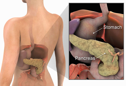 Cancerul pancreatic ia vedetele la rând. Ce simptome are boala care i-a ucis pe Jobs, Pavarotti şi Swayze
