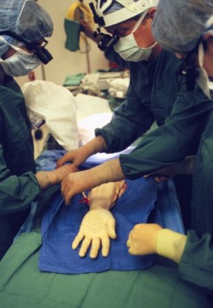 TRANSPLANT RECORD. Un bărbat a primit ambele mâini și picioare