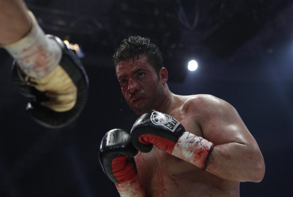 Klitschko şi-a umplut de sânge adversarul