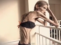 Cea mai anorexică femeie din lume. Are 39 de ani şi arată ca o mumie