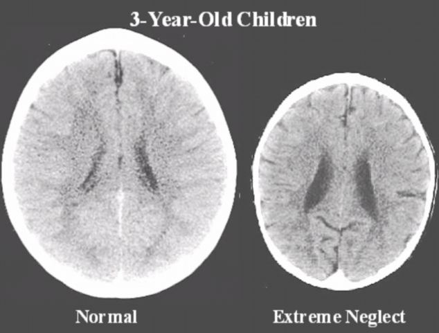 MOTIVUL NEAŞTEPTAT care dezvoltă creierul copiilor şi îi face SUPERINTELIGENŢI