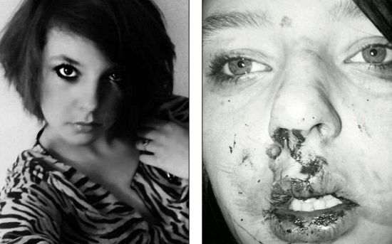A fost MUTILAT? ?i a devenit MODEL. Fata care le mul?ume?te agresorilor s?i