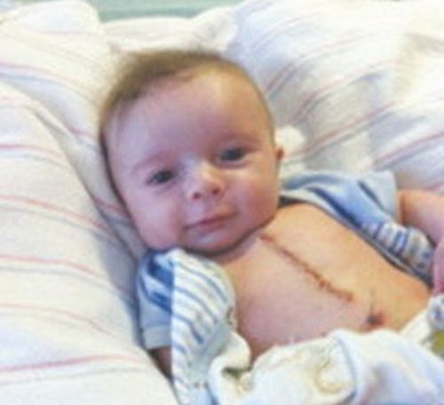 EMOŢIONANT. Un bebeluş zâmbeşte după operaţia pe cord deschis