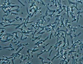 Locul cu CELE MAI MULTE BACTERII din organism. „Poate fi asem?nat cu ecosistemul unei p?duri tropicale”