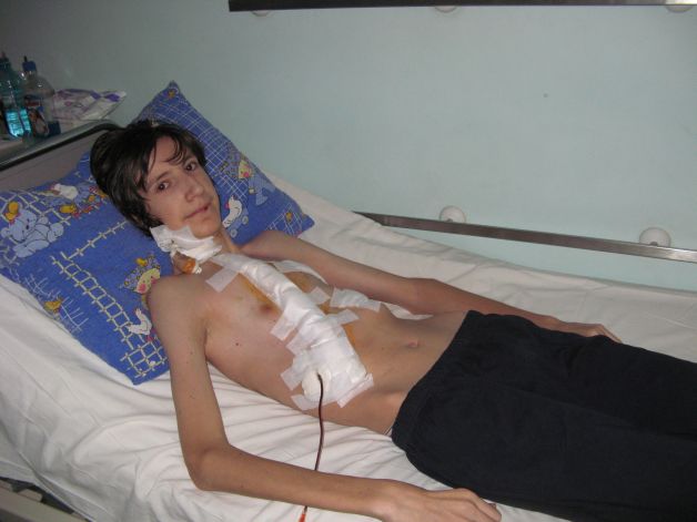PREMIER? MONDIAL?. Un medic român a inventat opera?ia care va salva mii de copii deforma?i