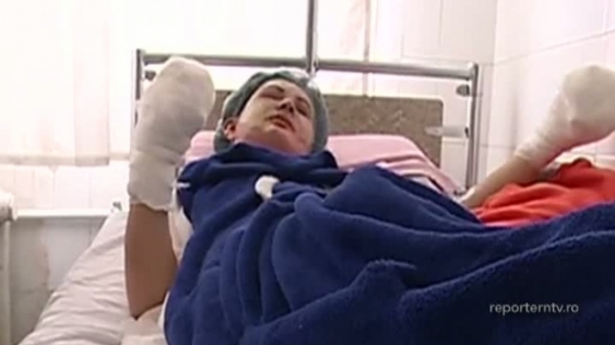 I-a ars mâinile şi faţa pentru că voia să-l părăsească. Pedeapsa cumplită aplicată de un bărbat nebun fostei iubite