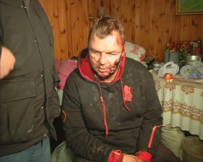 Administrația de la Kiev: Opozantul Dmitro Bulatov nu a fost TORTURAT