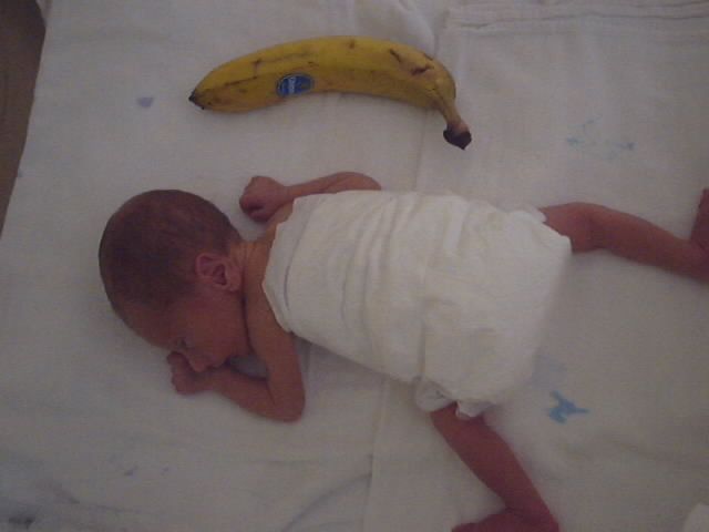 Povestea copilului "banană". Prematurul de 1.300 de grame care a ajuns campion la karate