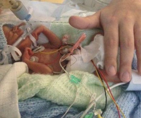 Secțiile de Reanimare nou-născuți, în pragul falimentului. Medic: „Ne pregătim să le închidem”