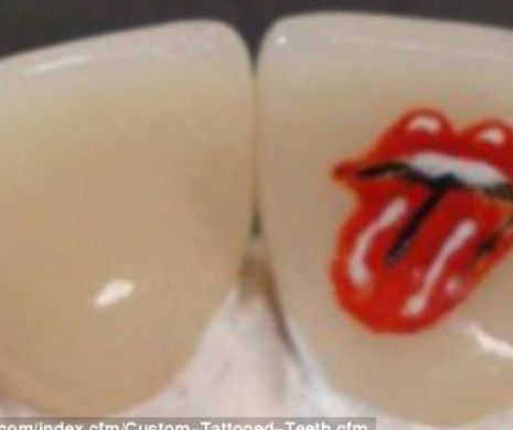 UIMITOR. Cum arată tatuajele dentare, cea mai nouă fiță în domeniu | GALERIE FOTO