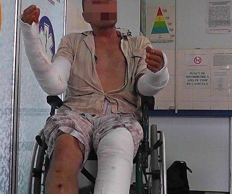EXCLUSIV EVZ. Polițiștii au bătut un bătrân cu lopata până l-au lăsat fără splină