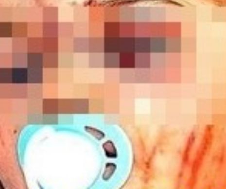 O fetiță de 10 luni a ajuns la spital după ce a luat canabis