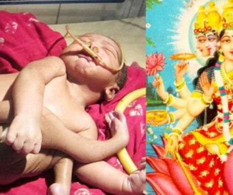 Un copil s-a născut cu opt membre. El seamănă cu divinităţile indiene