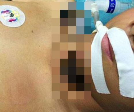 Accident GROAZNIC. După ce a fost lovit de un SCUTER, unui şcolar i s-au înfipt tacâmurile în GÂT. Imagini HORROR | FOTO