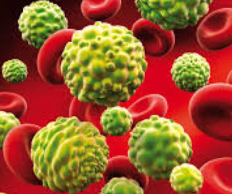 Cancerul care omoară cei mai mulți români. Semne de alarmă și metode de prevenire