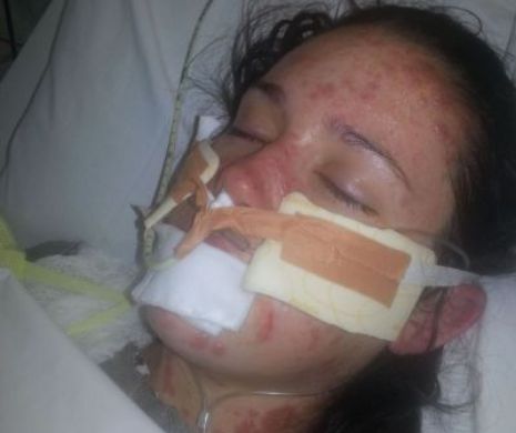 O tânără era să MOARĂ din cauza medicamentului prescris pentru boala foarte gravă de care suferă | Imagini cu impact emoţional puternic