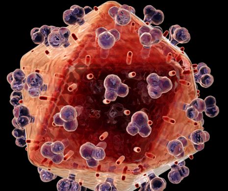 Se poate confunda ușor cu GRIPA. 14 semne de alarma ca ai putea fi INFECTAT cu HIV!