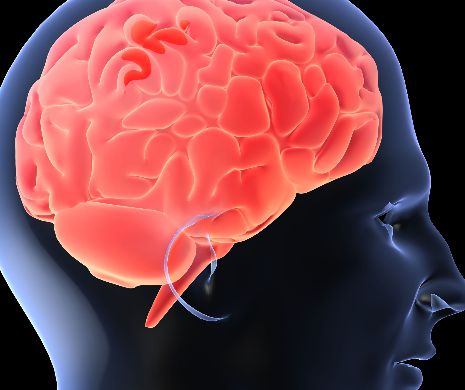Anumite medicamente care se pot lua fără rețetă cresc riscul de Alzheimer
