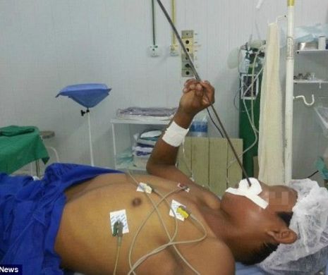 Cazul care a ÎNGROZIT un întreg spital. Un adolescent era să MOARĂ într-un mod INCREDIBIL. Doar în Pakistan s-a mai văzut aşa ceva!