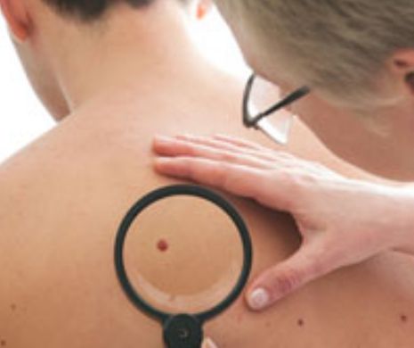 ”Medicamentul-minune” pe care îl iei în fiecare dimineață. Previne cea mai agresivă formă de cancer de piele