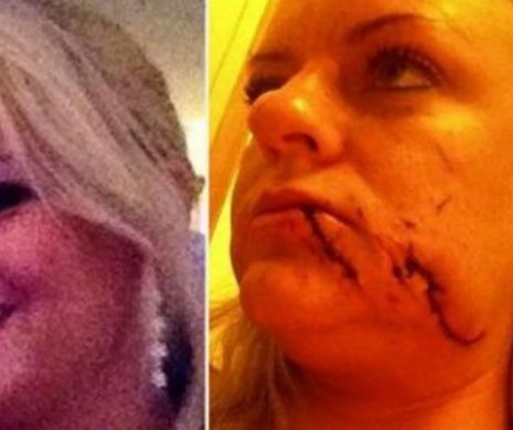 O domnișoară de onoare desfigurată la nunta prietenei sale