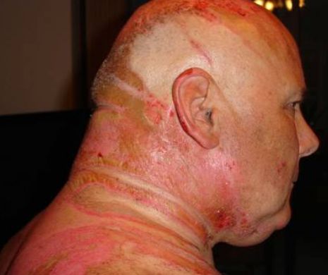 Ce a păţit un soţ care a vrut să divorţeze de soţia cheltuitoare. Imagini şocante!