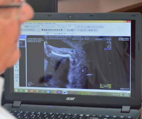 Centru de diagnosticare al malformațiilor fetale, la Timișoara. Acesta deservește tot vestul țării