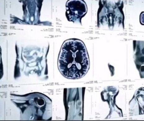 Ce boli poţi să dezvolţi în funcţie de luna în care te-ai născut
