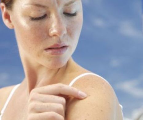 Ce modificări ale pielii anunță cancerul?