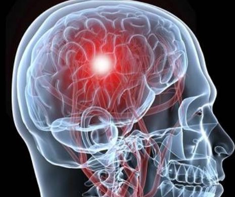 Cum se prepară ”medicamentele” naturale care opresc îmbătrânirea creierului și previn Alzheimerul