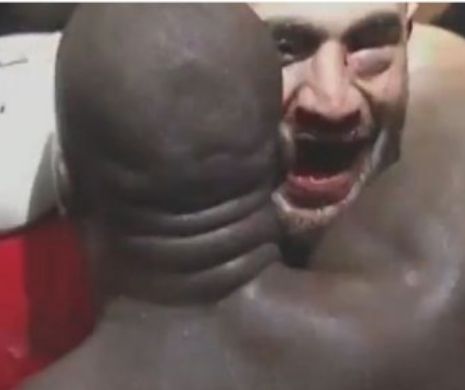 Badr Hari a fost BOMBARDAT in meciul anului! A castigat prin KO dar era greu de recunoscut la final! VIDEO