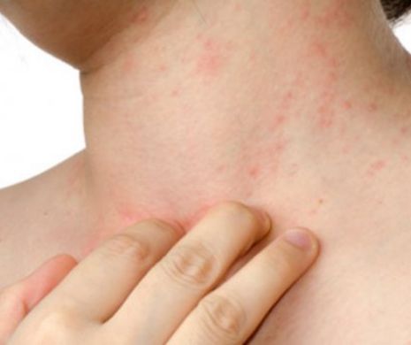 14 semne de alarmă că ai putea fi infectat cu HIV. Nu le ignora!