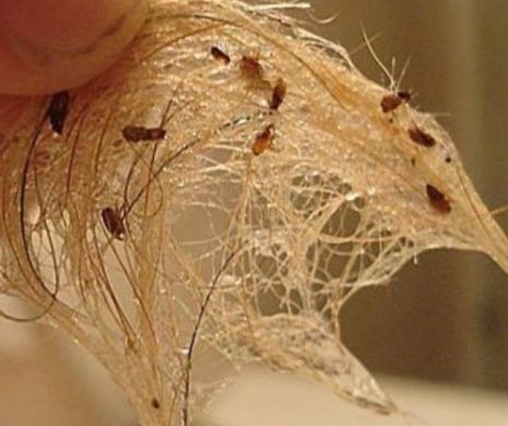 Cum iti scapi cainele de nesuferitii purici?