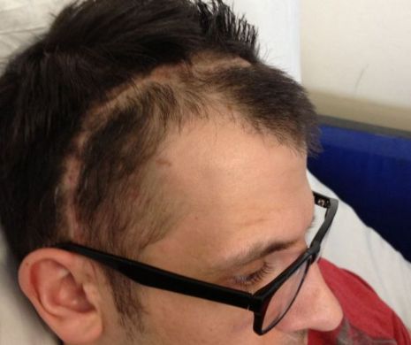 Cuplul care a trecut prin IAD: Bărbatul a suferit o hemoragie craniană şi i-a cerut iubitei să îl părăsească. Ce a urmat este INCREDIBIL