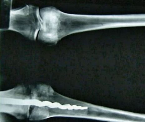 Descoperirea care ARUNCĂ în aer MEDICINA. Se schimbă tot ce se ştia până acum