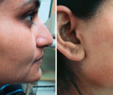 Scapi de părul facial și de coșuri cu doar două ingrediente naturale