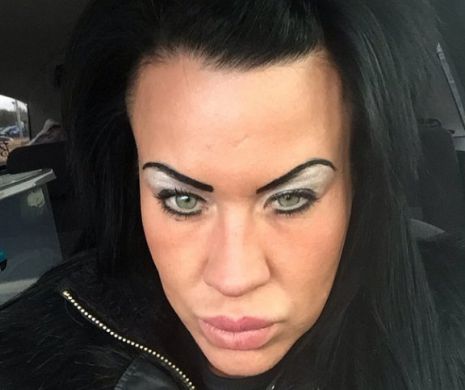 Este de coşmar ce a păţit o femei dependentă de Botox după ce a căzut şi s-a lovit la gură