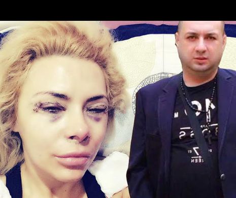 ULTIMA ORA! Jasmine, DESFIGURATA! Ce a patit ex-iubita lui Leo de la Strehaia