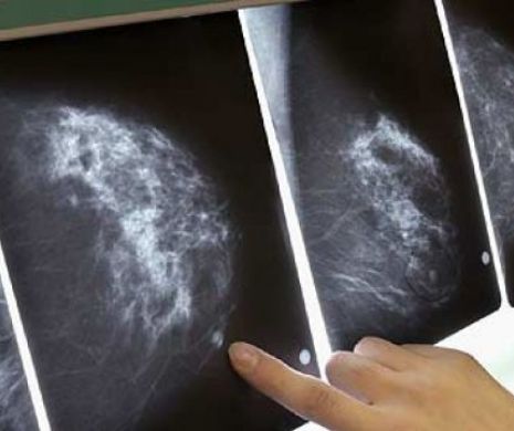 TOP 10 SEMNE ALE CANCERULUI ignorate de bărbaţii din toată lumea. AFLĂ-LE DACĂ ŢII LA VIAŢA TA