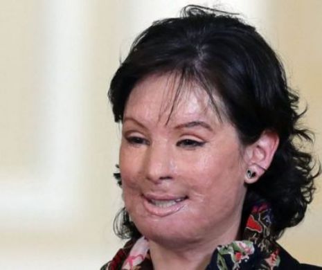 COLUMBIA adoptă legi drastice împotriva ATACATORILOR cu acid sulfuric