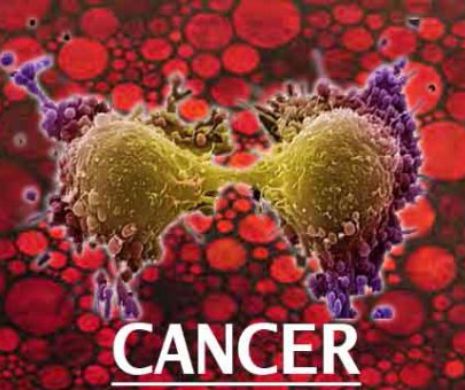 PERICOL IMENS pentru sănătatea noastră. CANCERUL LOVEŞTE de acolo de unde NU SE AŞTEPTA NIMENI. Atenţie maximă la ce BĂGĂM ÎN GURĂ