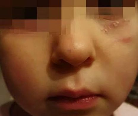 O fetita din Vaslui a venit de la gradinita cu fond de ten pe faţă. Cand a spalat-o, mama s-a speriat. Ce i-a spus fiica ei plangand