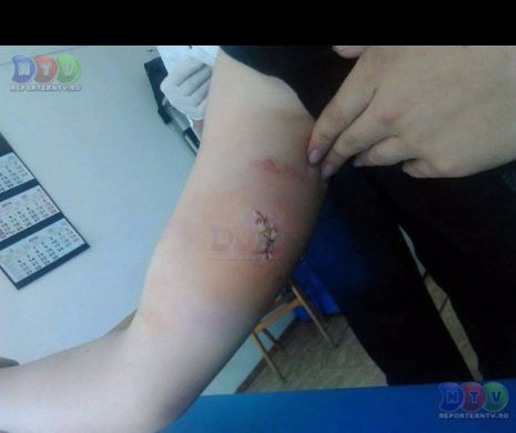 MINORĂ ÎNJUNGHIATĂ de un dezaxat care a vrut SĂ ÎI FURE TELEFONUL. Detalii şocante