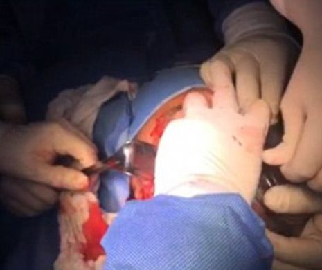 Acești MEDICI sunt ADEVĂRAȚI EROI. Au extras o GRENADĂ activă din CAPUL unui soldat. Putea fi sfârtecați cu toții în orice moment