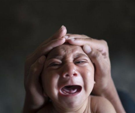 S-a născut PRIMUL COPIL din EUROPA cu MALFORMAȚII cauzate de VIRUSUL Zika